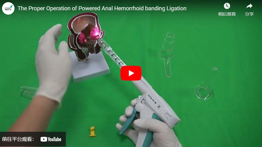 The Proper Operation of Powered Anal Hemorrhoid banding Ligation