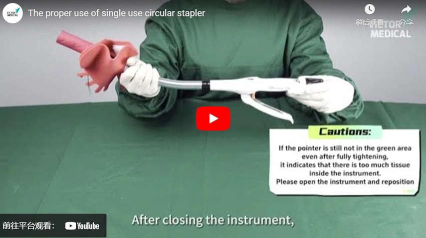 The Proper Operation of Single Use Circular Stapler